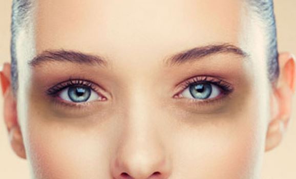 How do you get rid of dark circles?