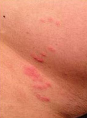 bumpy rash on arms #9