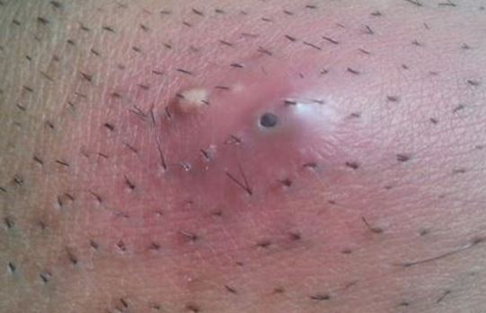 Advantages of shaved genitals - mobile porn video of genitals Advantages shaved