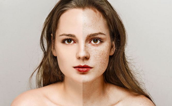 Does lemon juice really get rid of freckles?