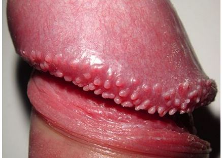 red rashes on penis