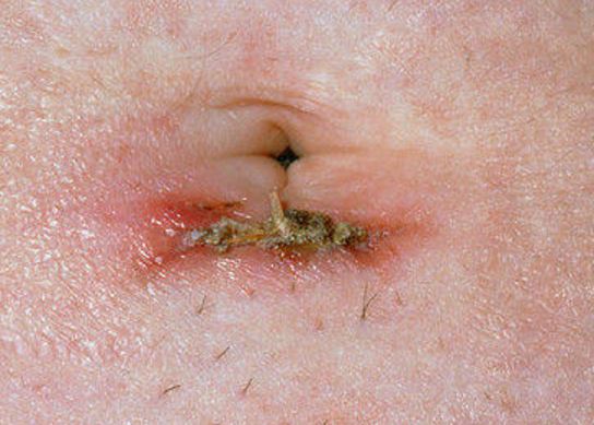 burning itching swelling after sex burning itching swelling after sex