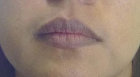 How Can I Get Rid Of Pink Eye Naturally How Can I Get Rid Of Pink Eye Naturally