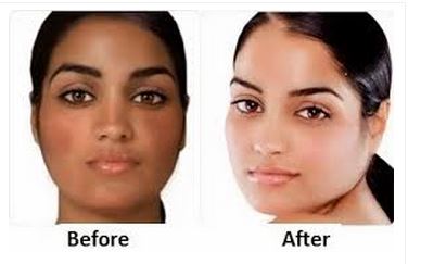 How to Lighten Skin Fast, Overnight, Permanently 