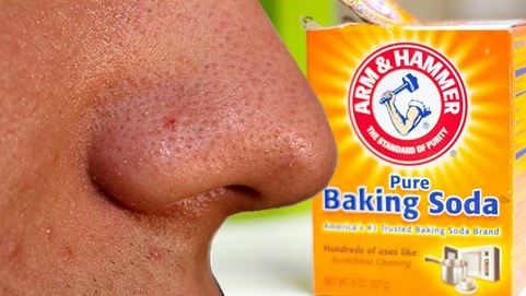 Baking soda for getting rid of sebaceous filaments