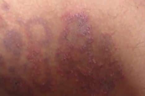 chafing anal rough friction Older hairy amatures