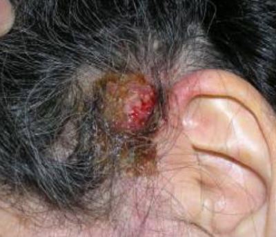 dried blood in hair dried blood in hair