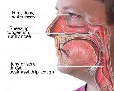 Throat Irritation Allergies 48