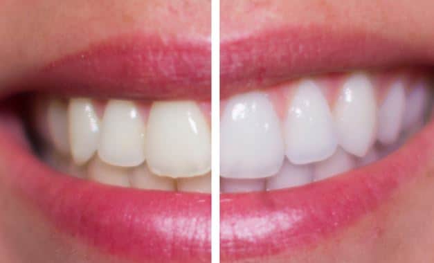 throat sore for solution Is Hydrogen with Safe, Benefits, How Gargling Peroxide it throat sore for solution Is Hydrogen with Safe, Benefits, How Gargling Peroxide it