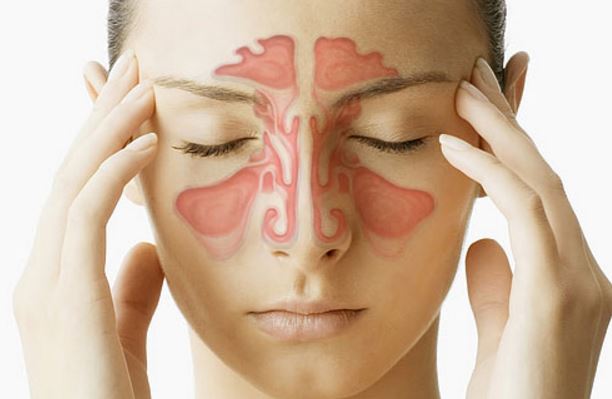You can get sores from sinus infection