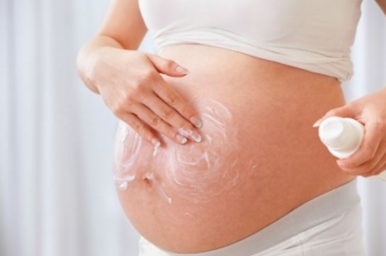 Pregnancy, without proper care can lead to stretch marks