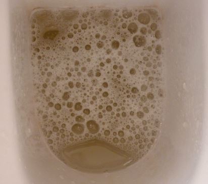 foggy smelly pee Foggy smelly pee