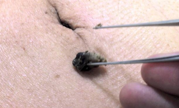 How To Clean My Belly Button Ring How To Clean My Belly Button Ring