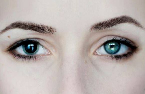 Aniscoria from anxiety or injury
